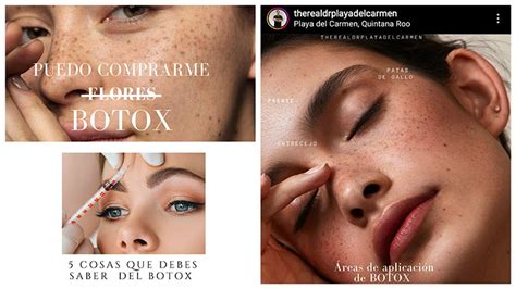 Botox playa del carmen. Things To Know About Botox playa del carmen. 